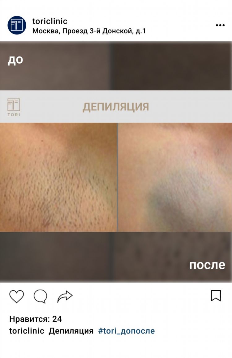 Шугаринг мужской частные объявления